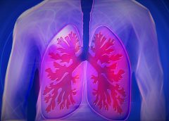 Săptămâna viitoare îți poți face radiografie pulmonară gratuită în Florești